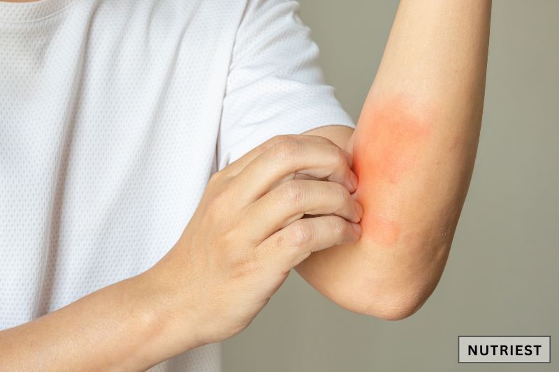 a person scratching an arm