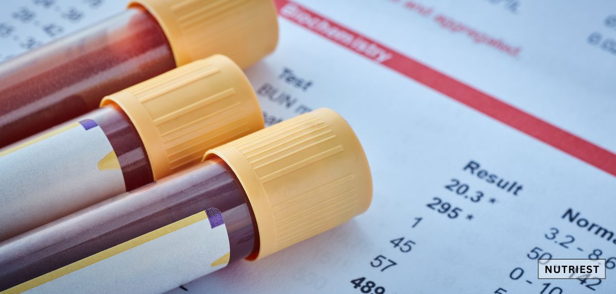 Blood test vials signifying the best iron supplement for anemia from beef blood