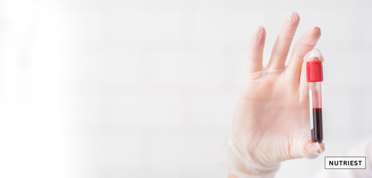 Gloved hand holding blood sample, illustrating best iron supplement for anemia from beef blood