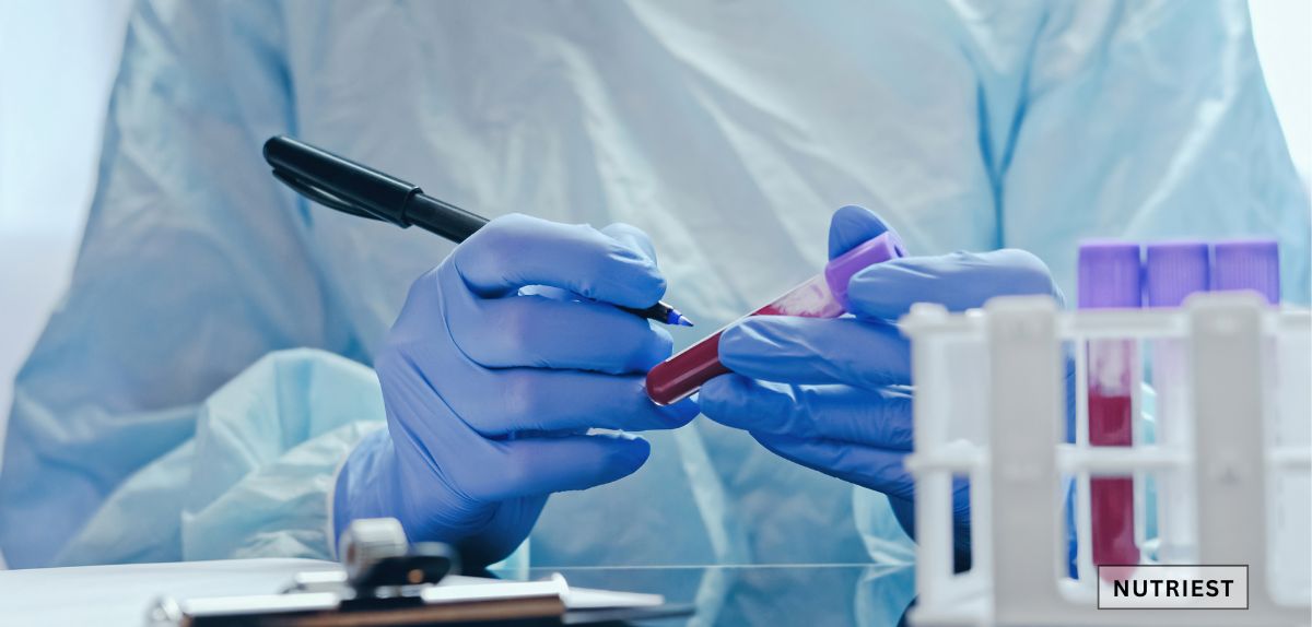 How long does it take for iron to be absorbed into the blood shown with lab test analysis.